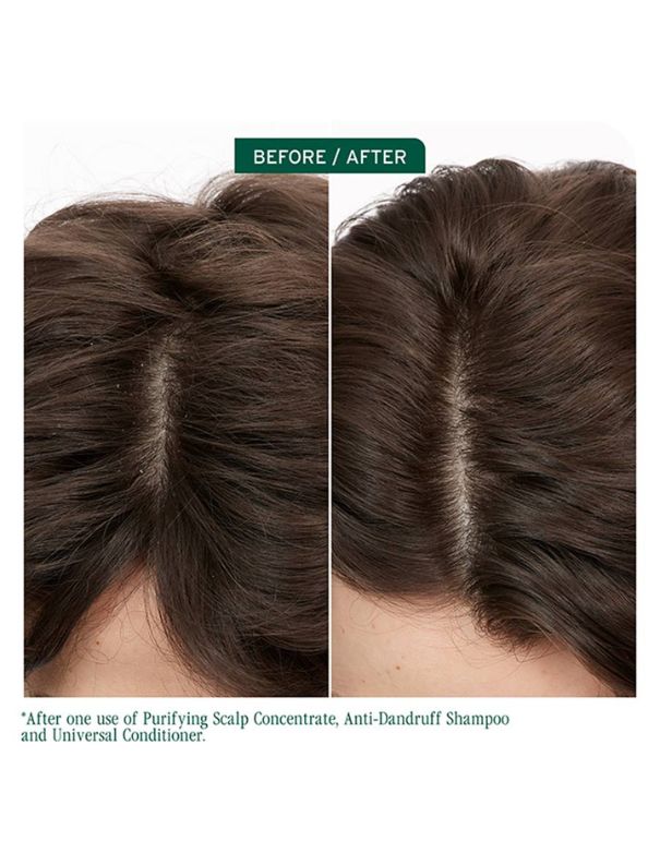 Shampooing antipelliculaire Biolage Scalp Sync - 400 ml