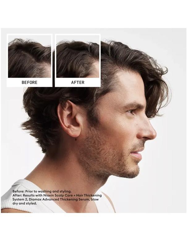 Shampoing Nioxin System 2 pour cuir chevelu et cheveux - 300 ml