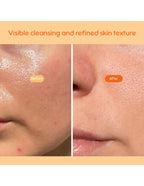 Kiero Refining Enzyme Cleanser - 50g