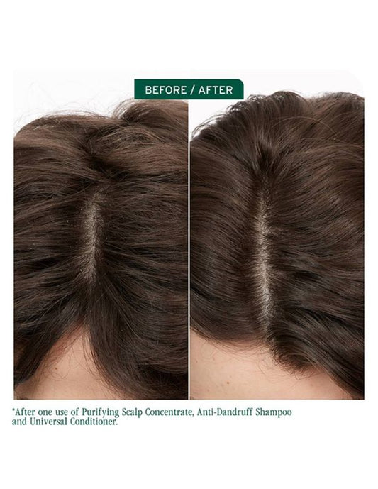 Shampooing antipelliculaire Biolage Scalp Sync - 400 ml